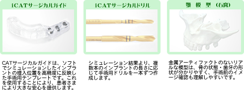 iCAT 3D インプラントシミュレーションシステム